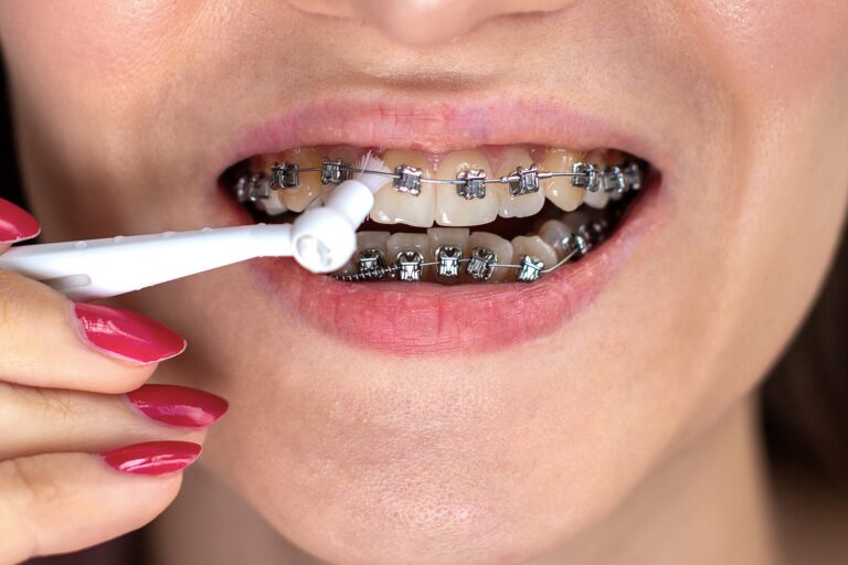 Dişleriniz İçin Bir Kurtarıcı: Periodontoloji Nedir ve Neden Önemlidir?