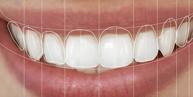 Diş İmplantı Nedir? Diş Hekimi Ahmet Dikici ile İmplant Tedavisi Hakkında Bilmeniz Gerekenler