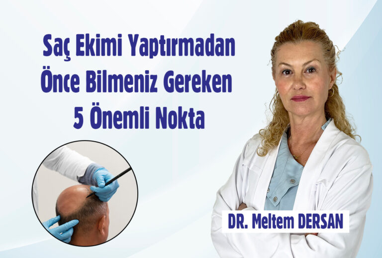 Saç Ekimi Yaptırmadan Önce Bilmeniz Gereken 5 Önemli Nokta