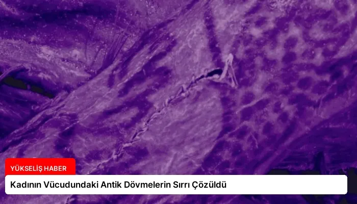 Kadının Vücudundaki Antik Dövmelerin Sırrı Çözüldü