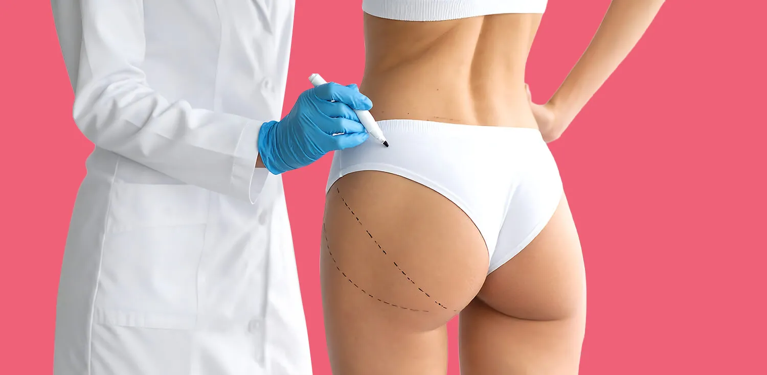 BBL İçin Türkiye’ye Gelenler Doktor Seçerken Nelere Bakıyor?